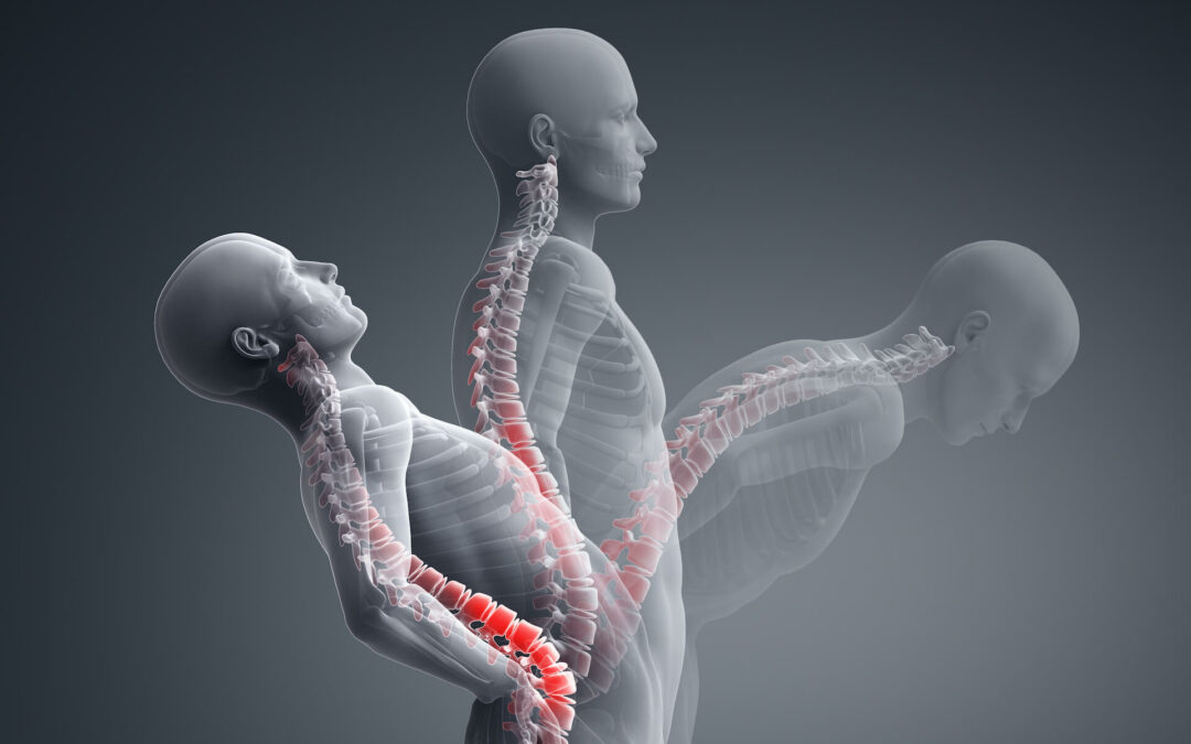 Regular chiropractic care helps prevent back pain